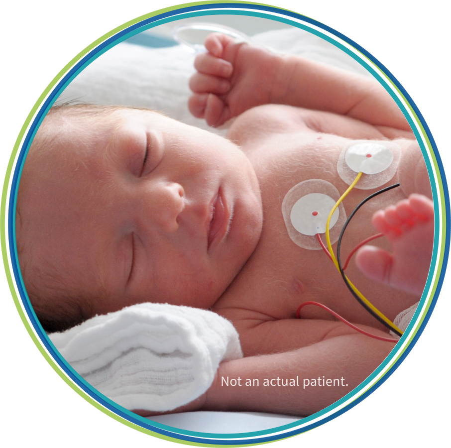 Infant being monitored by medical equipment