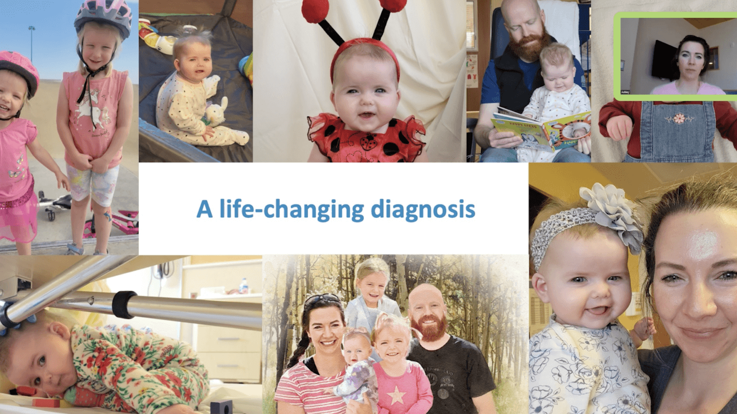 Understanding the congenital athymia patient journey video